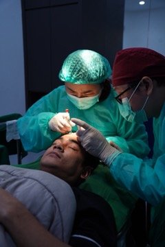 Integrafts hair transplant procedure