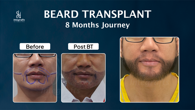 Hasil treatment 8