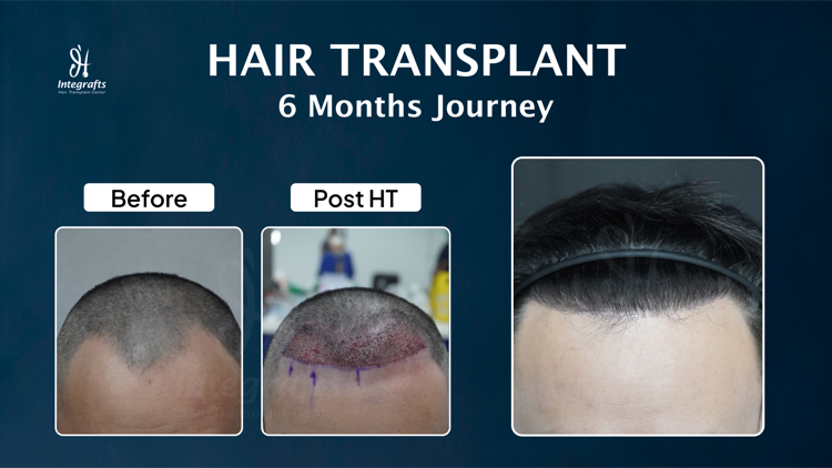 Hasil treatment 9