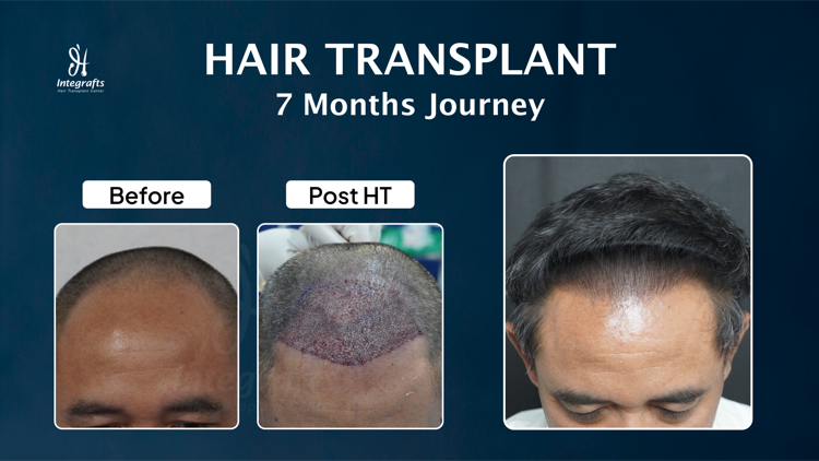 Hasil treatment 7