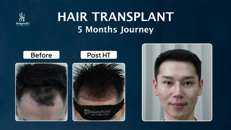 Hasil treatment 6