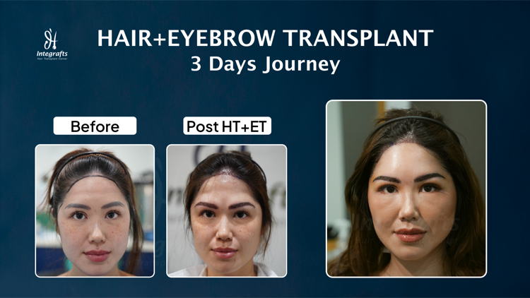 Hasil treatment 5