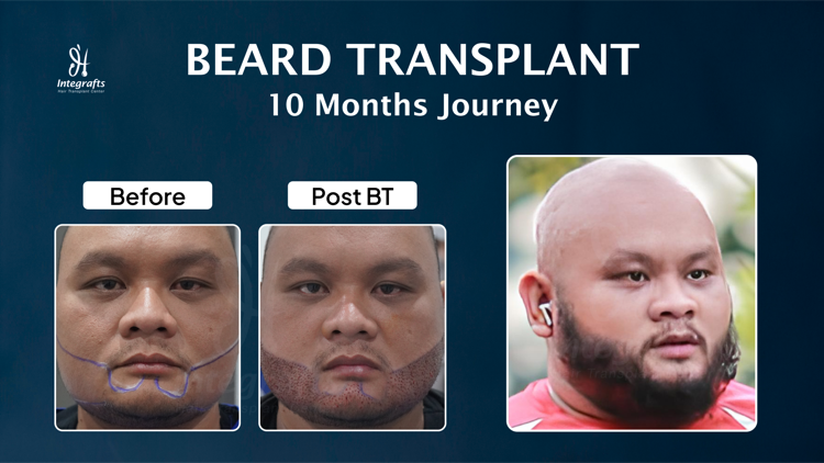 Hasil treatment 4