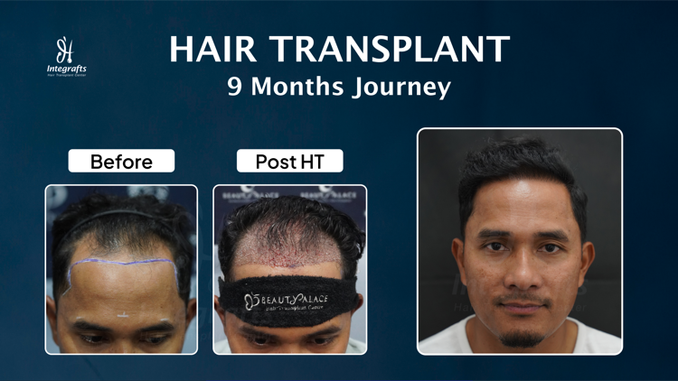 Hasil treatment 3