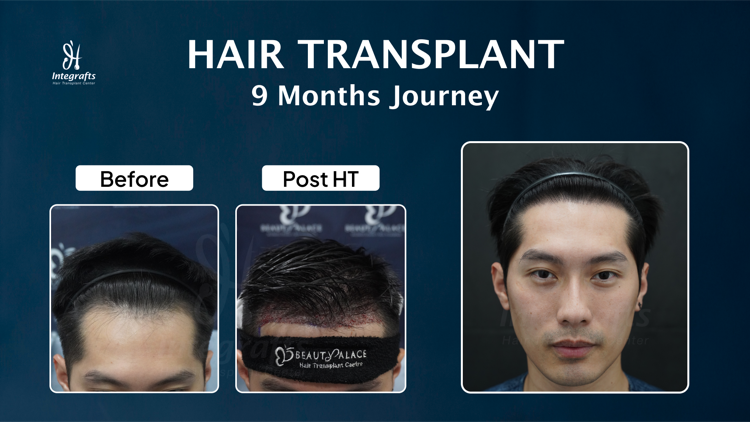 Hasil treatment 2