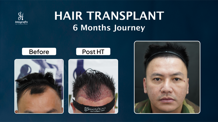Hasil treatment 1